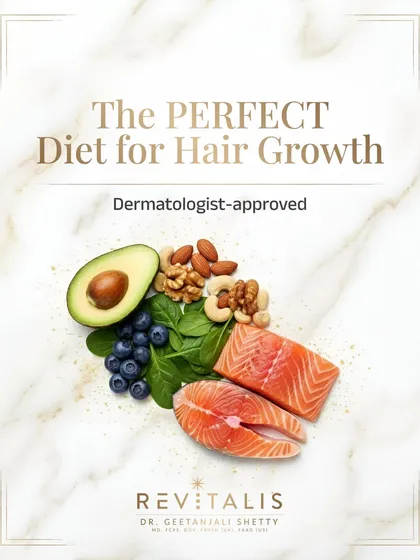 If you are struggling with hair fall, the solution is likely on your plate, not in a shampoo bottle. Your hair is made of protein and needs key nutrients like iron, omega-3, and specific vitamins to grow strong. I help you build a diet for healthy hair that addresses the root cause of the problem.