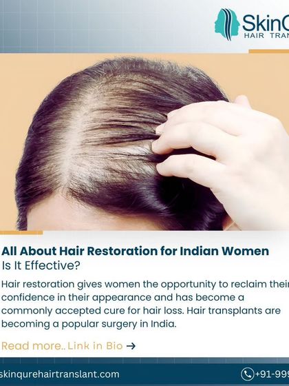 Hair restoration is becoming an increasingly popular and effective solution for Indian women facing hair loss. In my blog, I discuss the nuances of female hair transplants and their effectiveness in the Indian context.