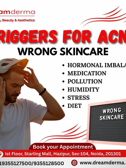 Understanding the triggers for your acne is key to treating it. This graphic outlines common causes like hormonal imbalance, pollution, stress, and using the wrong skincare. We help you identify your triggers for a more effective treatment plan.