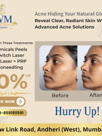 Acne & Scar Treatment