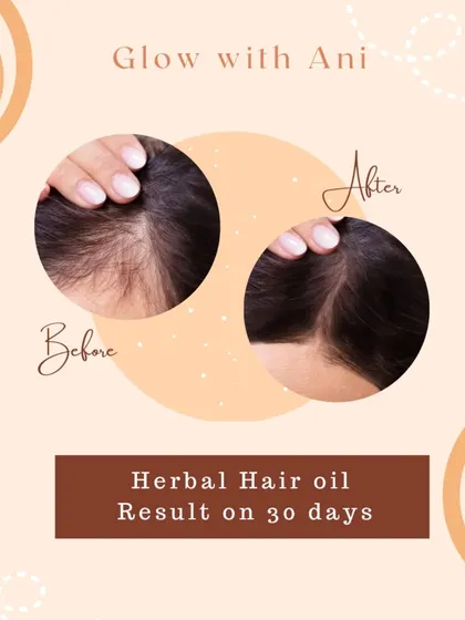 Just 30 days is all it takes to see a real difference. This is a real result from using my Herbal Hair Oil. It works by strengthening your roots and giving your scalp the nourishment it needs for healthy hair growth.