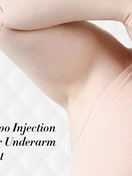 Many clients complain about stubborn underarm fat that no exercise can fix. For these small, specific areas, I use targeted Lipo Injections to precisely break down fat cells, resulting in a smoother, more defined contour.