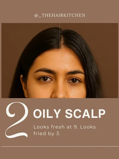 Does your hair look fresh at 9 AM but fried by 3 PM? You're dealing with an Oily Scalp personality.