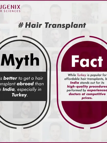 We tackle the biggest myths head-on: hair transplants are painful, only for celebrities, look fake, are dangerous, or are better done abroad.