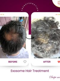 Hair & Scalp Treatments