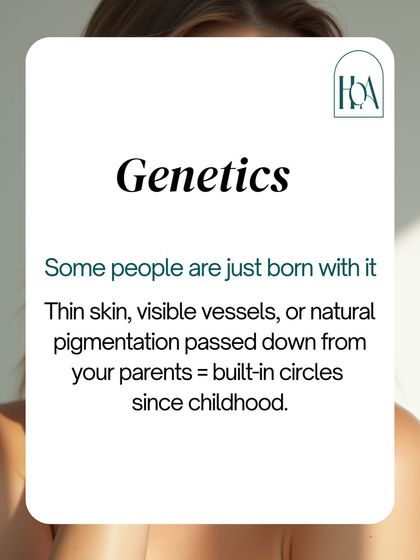 Sometimes, dark circles are simply genetic. Thin skin, visible blood vessels, or natural pigmentation passed down from your parents can create built-in circles that have been there since childhood and won't respond to topical creams.