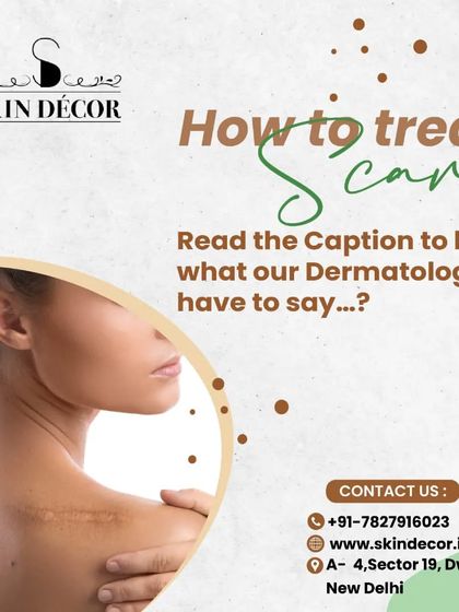 Treating scars requires a consistent and targeted approach. For raised scars, daily massage with an occlusive ointment, silicone gels, and in-clinic procedures like intralesional steroid injections can help soften, flatten, and reduce discomfort over time.