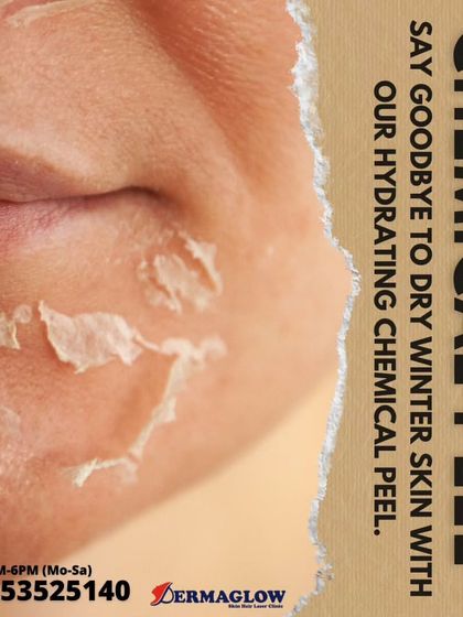 Chemical Peels for Skin Renewal photo 5