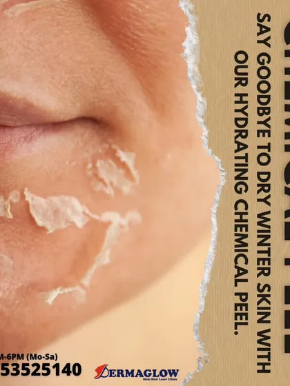 This image illustrates the skin peeling process that occurs after a chemical peel, which is essential for shedding dry, damaged skin. Our hydrating peels are particularly effective during winter to combat dryness and reveal a fresh layer of skin.