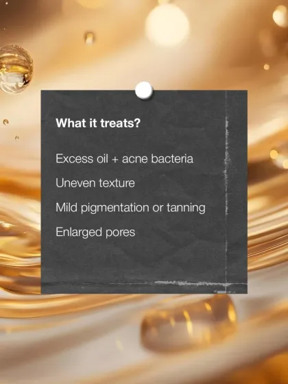 A summary of what the Carbon Facial treats. It is highly effective against excess oil, acne-causing bacteria, uneven skin texture, mild pigmentation or tanning, and enlarged pores.