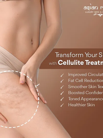 Cellulite is a common concern that I address with targeted treatments. My methods improve circulation and reduce fat cells, leading to smoother skin texture, a more toned appearance, and a significant boost in confidence.