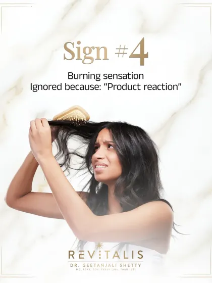 A burning or tingling sensation on the scalp is a major red flag. This is sign number four and is often mistaken for a simple product reaction, but it can indicate significant inflammation or a chemical sensitivity.