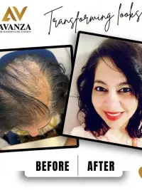 Non-Surgical Hair Growth Treatments