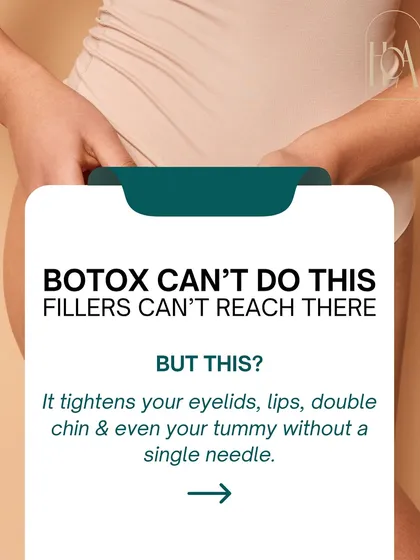 Botox can't tighten loose skin and fillers can't reach certain areas, but this technology can. The Exilis treatment is perfect for tightening eyelids, smoothing lip lines, and even firming the tummy without a single needle.