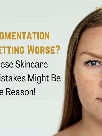 Is your pigmentation getting worse? This post introduces common skincare mistakes that might be the reason, encouraging users to learn more.
