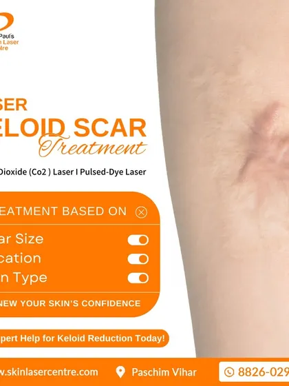 For more complex scars like keloids, I use advanced technology. This includes CO2 and Pulsed-Dye lasers, which allow me to precisely target and reduce raised scar tissue. I always tailor the laser treatment based on the scar's size, location, and your specific skin type.