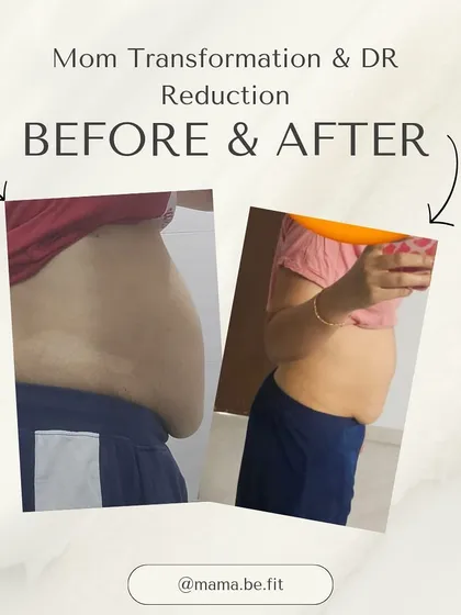 Progress worth celebrating. This before and after shows a reduction in diastasis recti and a more toned midsection, achieved through consistent, targeted exercises.