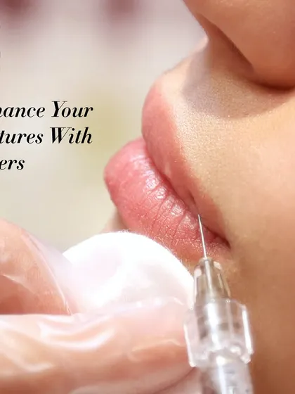 Here you can see a dermal filler injection up close. I use these injectables to enhance features by plumping areas that have lost volume over time, such as cheeks, under-eyes, or even recessed scars.