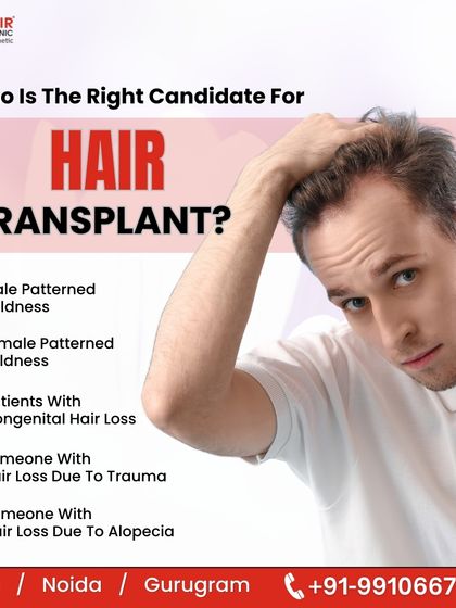 Wondering if a hair transplant is right for you? This guide outlines the ideal candidates, including those with male or female pattern baldness, congenital hair loss, or hair loss resulting from trauma or alopecia.