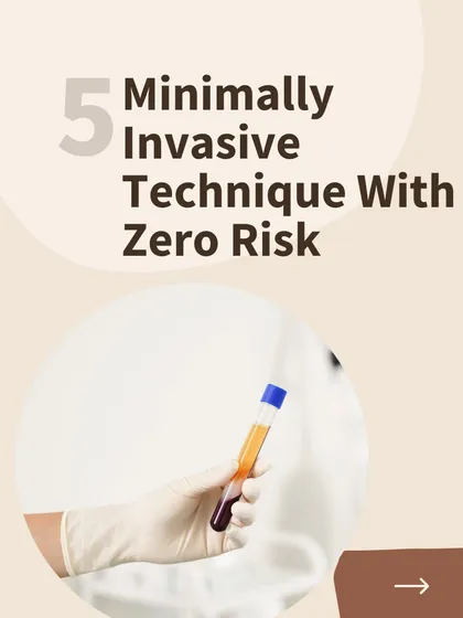Benefit 5 of PlasmoDerm: It is a minimally invasive technique with zero risk of allergic reaction since it uses your own blood.
