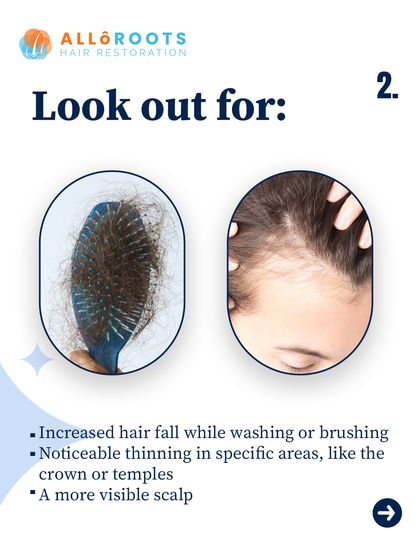 Look out for key indicators of hair thinning: more hair than usual on your brush or in the shower, a widening part, or noticeable thinning in specific areas like the temples. These are signs that your scalp needs attention.