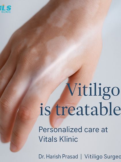 Vitals Klinic - Medical Dermatology Vitiligo & Pigment Restoration photo 7