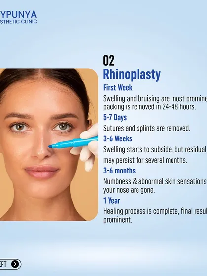 This graphic details the rhinoplasty recovery timeline, from splint removal at 5-7 days to the final results becoming prominent after one year of healing.