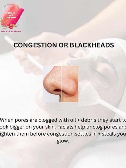 Blackheads and visible pores are a common concern caused by trapped oil and debris. Our pore cleansing facials are designed to gently extract these impurities and tighten pores, helping your skin to breathe and regain its natural glow.