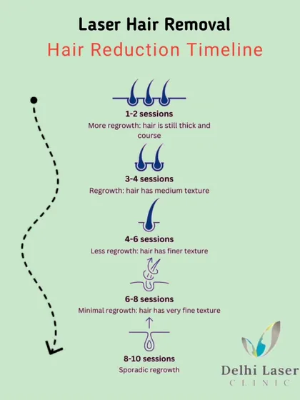 This timeline clearly explains what you can expect during your laser hair reduction journey with us. You will notice hair becoming finer and regrowth slowing down within the first few sessions, with minimal and sporadic regrowth after the full course of treatment. I believe in setting clear expectations for lasting results.