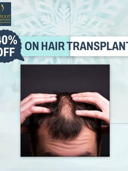 I believe in making hair restoration accessible. This graphic shows a special offer on hair transplant procedures, providing an opportunity to invest in a permanent solution for hair loss.