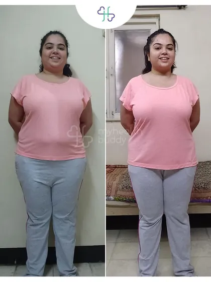 Losing 9 kgs in 12 weeks while managing PCOD and Thyroid. This client discovered that sustainable diets and constant support make the journey amazing.