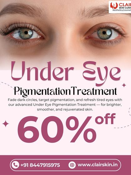 Fade dark circles and refresh tired eyes with our advanced Under Eye Pigmentation Treatment. This service is designed to give you brighter, smoother, and rejuvenated skin.