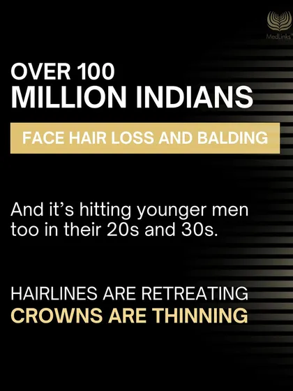Hair loss is a widespread issue, affecting over 100 million Indians, including men in their 20s and 30s. Understanding its prevalence is the first step toward seeking a solution.