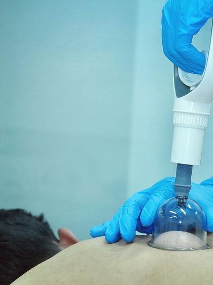 Cupping therapy is an ancient technique we use to decompress tissue and improve blood flow. Here, a therapist applies suction cups to a client's back to release muscle tension.