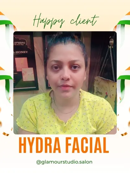 A happy client with a fresh, clear complexion after her Hydra Facial. Her satisfaction is our motivation.