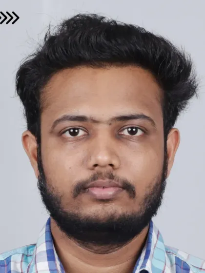 A fantastic 6-month result after implanting 5000 grafts. We recreated the hairline and filled the mid-scalp and crown area.