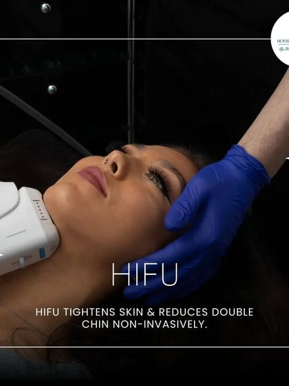 HIFU is one of my top picks for double chin reduction because it tightens the skin non-invasively. The focused ultrasound energy targets the underlying structure to create a more defined and sculpted profile.