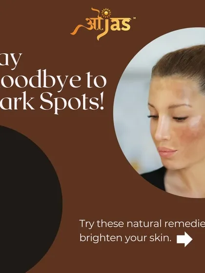 Say goodbye to dark spots with natural remedies. We're sharing some gentle, effective ways to brighten your skin at home.
