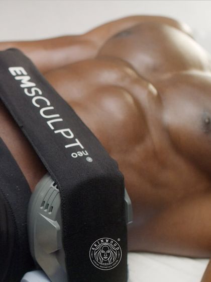 Emsculpt NEO is highly effective for sculpting and defining the male physique. Here, the applicator is used on the abdomen to build core strength and reveal chiseled abs by simultaneously burning fat and building muscle mass.