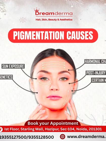 Understanding the cause of pigmentation is the first step to treating it. This educational graphic shows common causes like sun exposure, genetics, and hormonal changes.