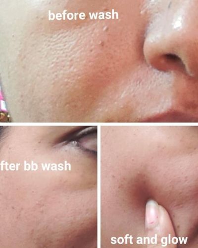 Pigmentation & Skin Brightening
