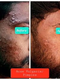 Clinical Dermatology