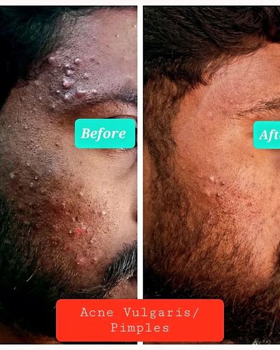 Clinical Dermatology
