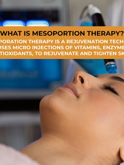 Mesoporation Therapy is a rejuvenation technique that uses micro-injections of vitamins, enzymes, and antioxidants. This process deeply nourishes the skin, helping to rejuvenate and tighten it for a healthier, more radiant appearance.