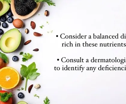 To combat nutritional deficiencies linked to hair loss, I recommend a balanced diet rich in these key nutrients. If you suspect a deficiency, a consultation can help identify and address it properly.