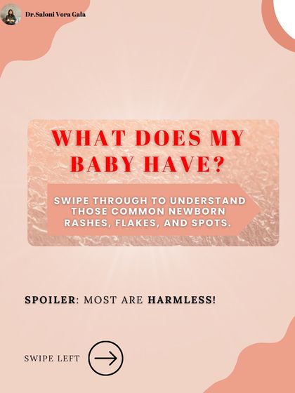New parents often worry about rashes and spots on their baby's skin. This guide is here to help you understand common newborn skin concerns. Spoiler: most of them are completely harmless!