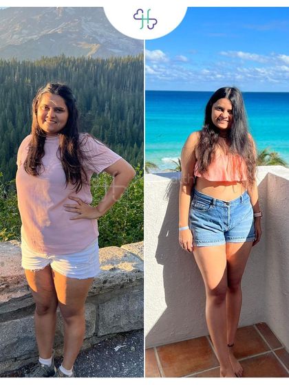 Ruchika lost 10 kgs in 12 weeks and finally fit into clothes she had saved for years. We modified her usual meals instead of introducing a restrictive diet.