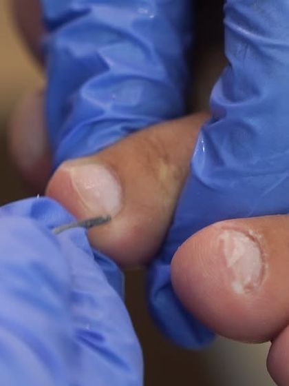 Attention to detail is key in a professional pedicure. Here, I am carefully tending to the cuticles to ensure a clean and polished look, promoting healthy nail growth.