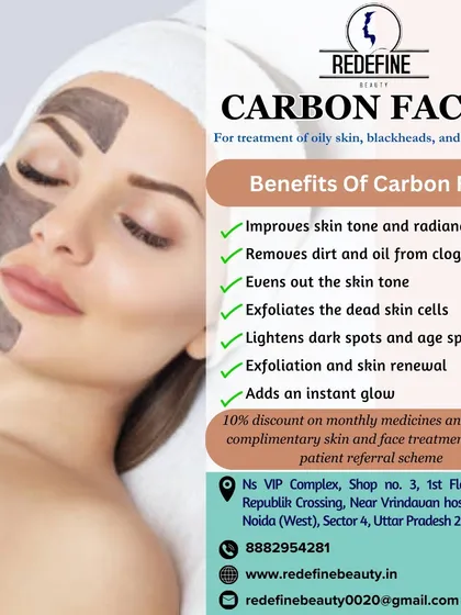 An informational graphic about the Carbon Facial, perfect for treating oily skin, blackheads, and whiteheads. It improves skin tone, removes dirt from clogged pores, and adds an instant glow.