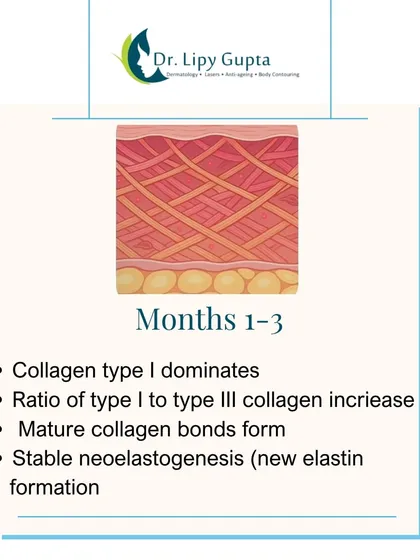 In months 1 to 3, mature collagen dominates and stable new elastin forms. This is when you see the most significant improvements in skin firmness and texture.